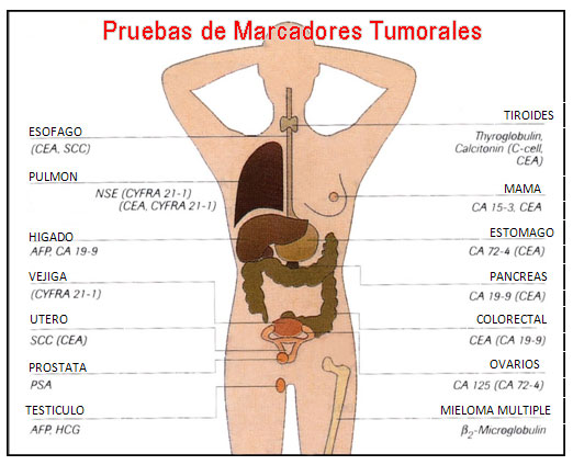 Marcadores tumorales: medicina de – CDI Marbella